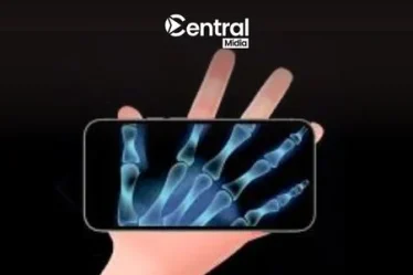 Melhores Aplicativos de Raio-X para Celular